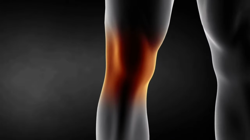 An Illustration of A Knee Highlighting Areas of Pain and Inflammation with A Dark Background