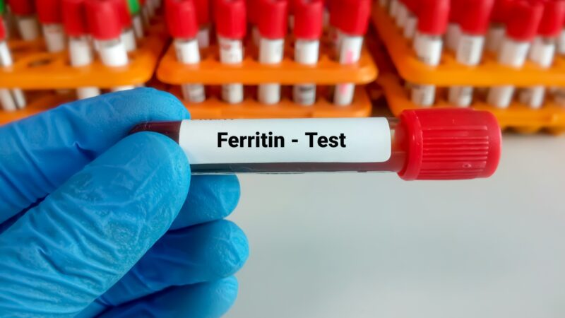 Gloved hand holds a ferritin blood test sample for iron and stamina assessment
