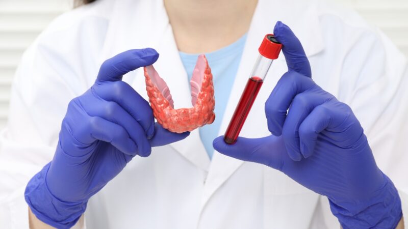 Doctor holds a thyroid model and blood sample for hormone testing